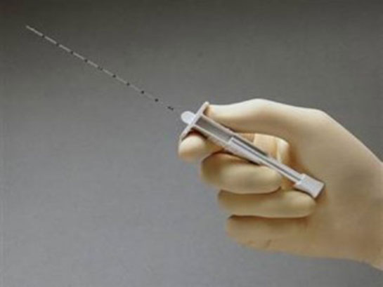 Biyopsi Çeşitleri Nelerdir?