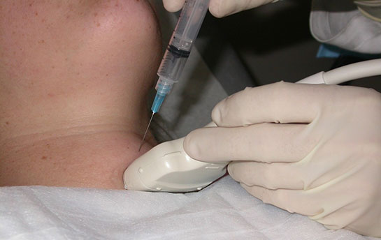 Biyopsi Nasıl Yapılır?