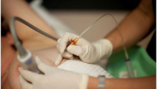 İnsizyonel Biyopsi Nedir ve Nasıl Yapılır?