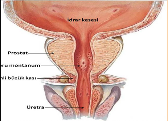 Prostat Biyopsisi Nedir ve Nasıl Yapılır?