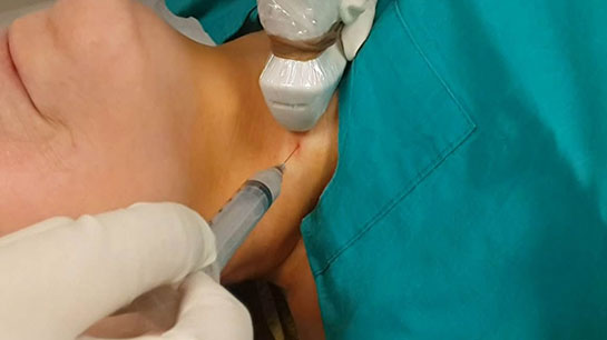 Tiroid Biyopsi Özellikleri ve Faydaları Nelerdir?